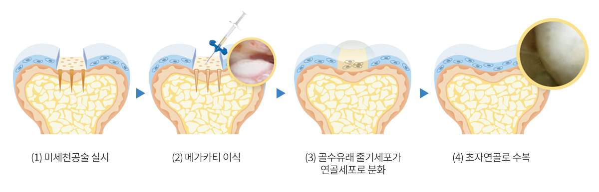 메가카티