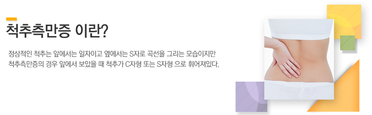 척추측만증이란?정상적인 척추는 앞에서는 일자이고 옆에서는 s자로 곡선을 그리는 모습이지만 척추측만증의 경우 앞에서 보았을 때 척추가 C자형 또는 S자형 으로 휘어져있다.