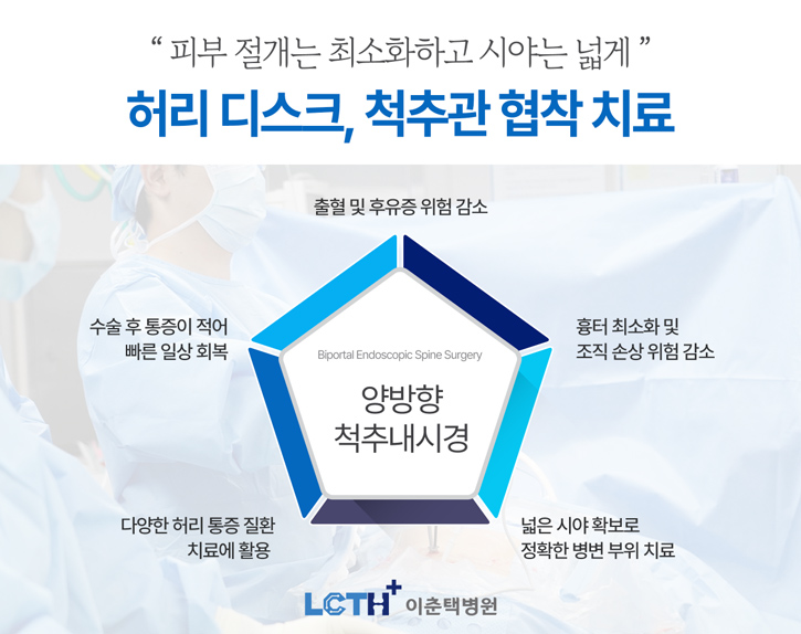 양방향 척추내시경이란?