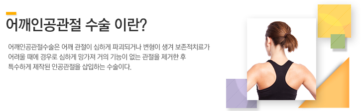 어깨인공관절수술이란? 어깨인공관절수술은 어깨 관절이 심하게 파괴되거나 변형이 생겨 보존적치료가 어려울 때에 하는 경우로 심하게 망가져 거의 기능이 없는 관절을 제거한 후 특수하게 제작된 인공관절을 삽입하는 수술이다.<br />수술 후 적극적인 물리치료가 정상적인 관절운동범위 및 정상기능을 돕기 위해 시행한다.