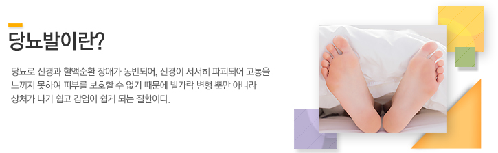 발바닥의 안쪽 아치가 비정상적으로 낮아지거나 소실되는 변형으로 발바닥이 평평해지기 때문에 발 전체가 땅아 보행에 문제를 유발할 수 있는 질환이다. 
