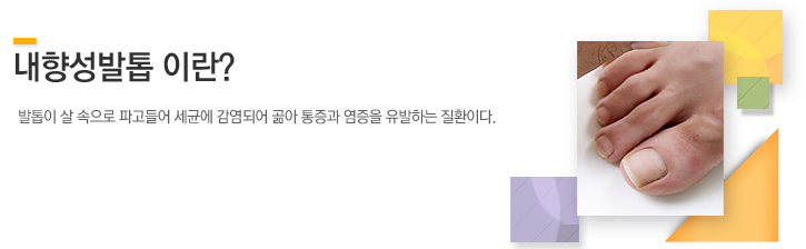 발톱이 살 속으로 파고들어 세균에 감염되어 곪아 통증과 염증을 유발하는 질환이다.