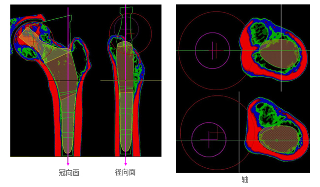 3 Plane View Planning 