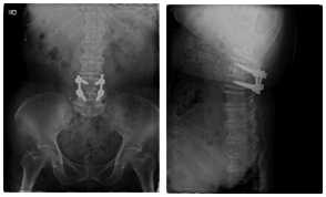 CERVICAL 사진